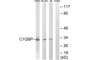 Western blot analysis of extracts from Jurkat cells, K562 cells and HUVEC cells, using C1QBP antibody. (C1QBP 抗体  (Internal Region))
