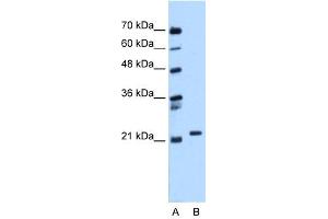WB Suggested Anti-RAB11B Antibody Titration:  0. (RAB11B 抗体  (C-Term))