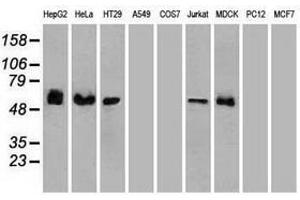 Image no. 6 for anti-Checkpoint Kinase 2 (CHEK2) antibody (ABIN1497499) (CHEK2 抗体)