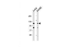Western Blot at 1:1000 dilution Lane 1: Jurkat whole cell lysate Lane 2: SW480 whole cell lysate Lysates/proteins at 20 ug per lane. (MAP3K9 抗体  (C-Term))