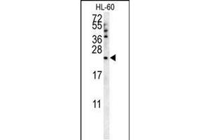 Western blot analysis in HL-60 cell line lysates (35ug/lane). (Coq7 抗体  (C-Term))
