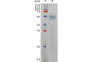 Interleukin 12 beta (IL12B) (AA 23-328) protein (His tag)