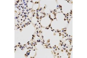 Immunohistochemistry of paraffin-embedded mouse lung using Asymmetric DiMethyl-Histone H3-R17 antibody (ABIN1872982) at dilution of 1:200 (40x lens). (Histone 3 抗体  (H3R17me2a))