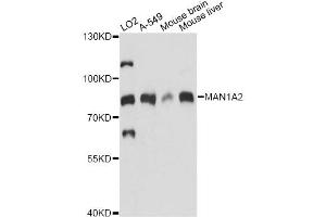 Western blot analysis of extracts of various cell lines, using MAN1A2 antibody. (MAN1A2 抗体)