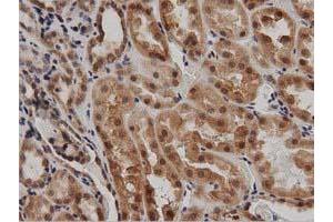 Image no. 3 for anti-DnaJ (Hsp40) Homolog, Subfamily A, Member 2 (DNAJA2) antibody (ABIN1497858) (DNAJA2 抗体)