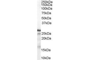 ABIN184587 (1µg/ml) staining of Human Breast lysate (35µg protein in RIPA buffer).