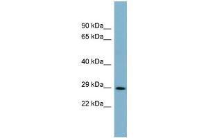 WB Suggested Anti-DCUN1D1  Antibody Titration: 0. (DCUN1D1 抗体  (Middle Region))