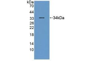 Detection of Recombinant ANTXR2, Human using Polyclonal Antibody to Anthrax Toxin Receptor 2 (ANTXR2) (ANTXR2 抗体  (AA 34-318))