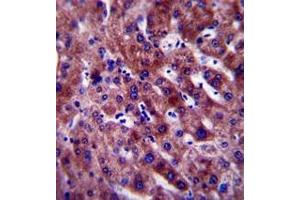 Immunohistochemistry analysis in formalin fixed and paraffin embedded human liver tissue reacted with PON1 Antibody (Center) followed which was peroxidase conjugated to the secondary antibody and followed by DAB staining. (PON1 抗体  (Middle Region))
