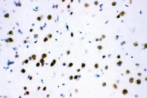 Immunohistochemistry (IHC) image for anti-Activating Transcription Factor 2 (ATF2) (AA 93-450) antibody (ABIN3043791)