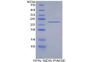 SDS-PAGE (SDS) image for Acetylcholinesterase (AChE) (AA 377-574) protein (His tag) (ABIN1098810) (Acetylcholinesterase Protein (AChE) (AA 377-574) (His tag))