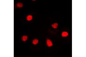 Immunofluorescent analysis of hnRNP G staining in Jurkat cells. (RBMX 抗体  (N-Term))