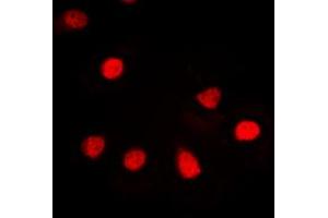 Immunofluorescent analysis of hnRNP G staining in Jurkat cells.