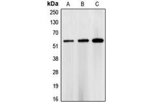 Western blot analysis of CHK1 expression in HEK293T (A), NIH3T3 (B), rat heart (C) whole cell lysates. (CHEK1 抗体  (Center))