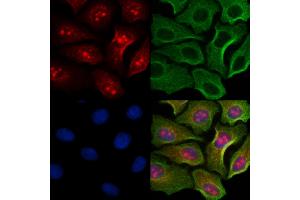 ABIN6254919 and ABIN6267567 staining H2O2 treated Hela cells by IF/ICC.