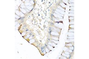 Immunohistochemistry of paraffin-embedded human colon using CPA1 antibody. (CPA1 抗体)
