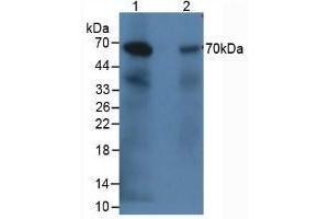 Western blot analysis of (1) Rabbit Kidney Tissue and (2) Rabbit Heart Tissue. (C9 抗体  (AA 139-519))