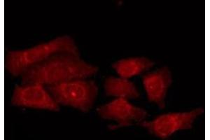 ABIN6275538 staining HepG2 by IF/ICC. (PRKY 抗体)