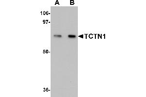 Western Blotting (WB) image for anti-Tectonic Family Member 1 (TCTN1) (N-Term) antibody (ABIN1031607) (TCTN1 抗体  (N-Term))