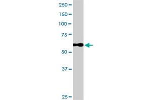 CALD1 MaxPab rabbit polyclonal antibody. (Caldesmon 抗体  (AA 1-538))