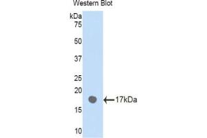 Western blot analysis of the recombinant protein. (PLXNB1 抗体  (AA 47-173))