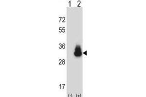 Western Blotting (WB) image for anti-Carcinoembryonic Antigen-Related Cell Adhesion Molecule 3 (CEACAM3) antibody (ABIN2997578) (CEACAM3 抗体)