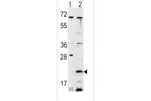 Western blot analysis of FXN using rabbit polyclonal FXN Antibody using 293 cell lysates (2 ug/lane) either nontransfected (Lane 1) or transiently transfected with the FXN gene (Lane 2). (Frataxin 抗体  (C-Term))