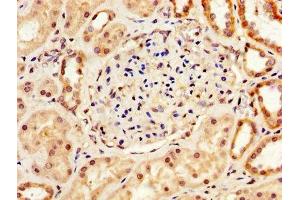 IHC image of ABIN7166424 diluted at 1:200 and staining in paraffin-embedded human kidney tissue performed on a Leica BondTM system. (LOX 抗体  (AA 174-417))