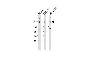 Western Blot at 1:2000 dilution Lane 1: MCF-7 whole cell lysate Lane 2: MOLT-4 whole cell lysate Lane 3: SH-SY5Y whole cell lysate Lysates/proteins at 20 ug per lane. (CUX1 抗体  (C-Term))