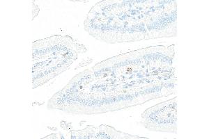 Immunohistochemistry (IHC) image for anti-Lymphocyte-Activation Gene 3 (LAG3) (AA 250-300) antibody (ABIN7795656)