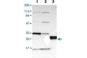 Western Blot analysis of (1) Human RT-4 cell, (2) Human U-251MG sp cell, (3) Human plasma (IgG/HSA depleted). (PRELID1 抗体)
