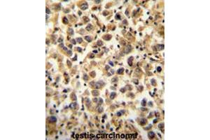 CCDC19 Antibody (N-term) immunohistochemistry analysis in formalin fixed and paraffin embedded human testis carcinoma followed by peroxidase conjugation of the secondary antibody and DAB staining. (CCDC19 抗体  (N-Term))