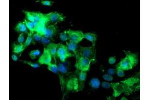 Image no. 4 for anti-Src-like-adaptor 2 (SLA2) antibody (ABIN1500946)