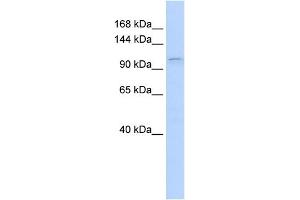 WB Suggested Anti-PGR Antibody Titration:  0. (Progesterone Receptor 抗体  (N-Term))