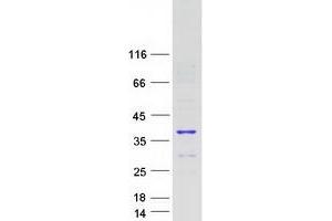 Validation with Western Blot