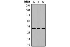 Western blot analysis of Adenosine A2b Receptor expression in SHSY5Y (A), NIH3T3 (B), rat kidney (C) whole cell lysates.