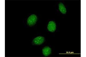 Immunofluorescence of purified MaxPab antibody to SSBP2 on HeLa cell. (SSBP2 抗体  (AA 1-361))