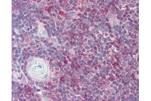 Image no. 1 for anti-RAN, Member RAS Oncogene Family (RAN) (AA 1-179) antibody (ABIN467626) (RAN 抗体  (AA 1-179))