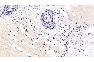 Immunohistochemistry (IHC) image for anti-Programmed Cell Death 1 (PDCD1) (AA 41-132) antibody (ABIN7440431)