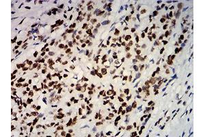 Immunohistochemistry (IHC) image for anti-Estrogen Receptor 1 (ESR1) (AA 2-185) antibody (ABIN5542593)