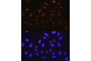 Immunofluorescence analysis of U-2 OS cells using Fibrillarin/U3 RNP Rabbit mAb (ABIN7267175) at dilution of 1:100 (40x lens).