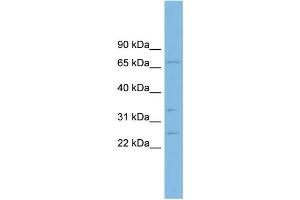 WB Suggested Anti-GRAP Antibody Titration: 0. (GRAP 抗体  (Middle Region))
