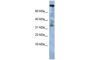 Western Blotting (WB) image for anti-Zinc Finger Protein 251 (ZNF251) antibody (ABIN2458235) (ZNF251 抗体)