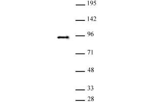 SATB2 antibody (pAb) tested by Western blot. (SATB2 抗体  (C-Term))