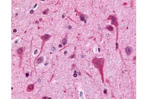 Anti-GPR75 antibody IHC of human brain, neurons and glia. (GPR75 抗体  (C-Term))