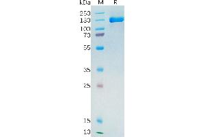 Folate Hydrolase (Prostate-Specific Membrane Antigen) 1 (FOLH1) protein (Fc Tag)