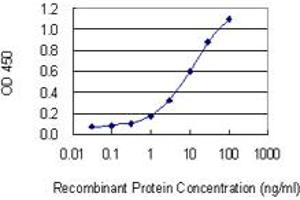 Detection limit for recombinant GST tagged CNR2 is 0. (CNR2 抗体  (AA 302-360))