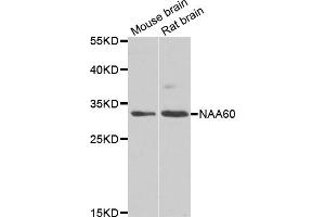 Western blot analysis of extracts of various cell lines, using NAA60 antibody (ABIN5975517) at 1/1000 dilution. (NAT15 抗体)