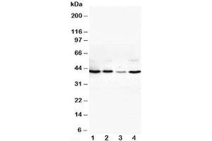 Western blot testing of VEGFD antibody and Lane 1:  SW620;  2: COLO320;  3: 6T-CEM;  4: HT1080 cell lysate (VEGFD 抗体  (Middle Region))