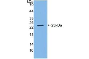 Detection of Recombinant SGPL1, Mouse using Polyclonal Antibody to Sphingosine 1 Phosphate Lyase 1 (SGPL1) (SGPL1 抗体  (AA 382-568))